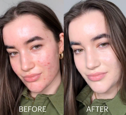 Dr.Jart+ Cicapair Tiger Grass Color Correcting Treatment • Skincare Chile | ISEORA